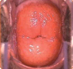 õͼƬ